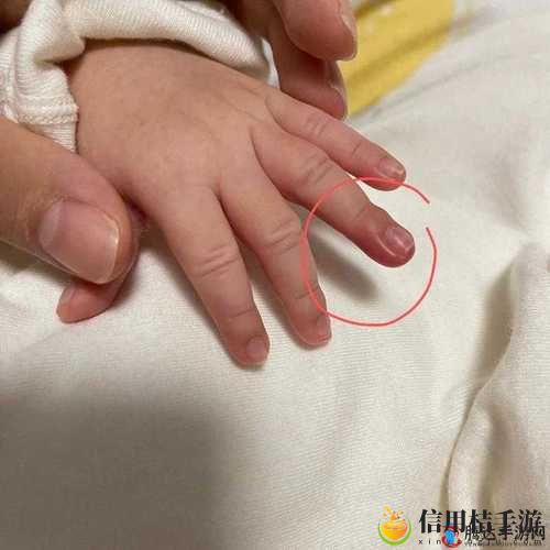 宝宝怎么才三根手指就痛?这是怎样的一种不适感,让父母们心急如焚