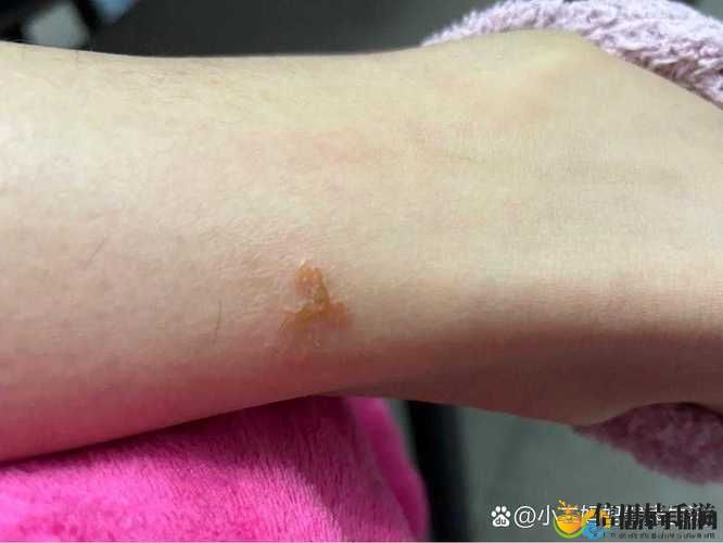 淑芬两腿间又痒痒火爆上线,平台:全网热议