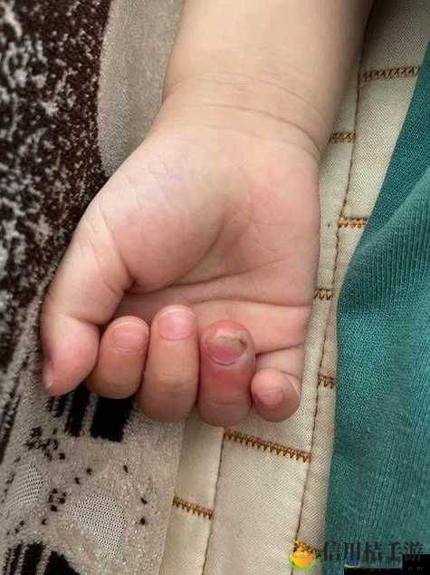 宝宝这才两根手指就受不了了,平台:亲子育儿网